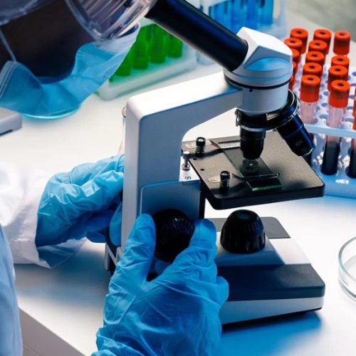 Exame é capaz de diagnósticar de Alzheimer com 10 anos de antecedência